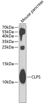 Western blot analysis of extracts of mouse pancreas using CLPS Polyclonal Antibody at 1:1000 dilution.