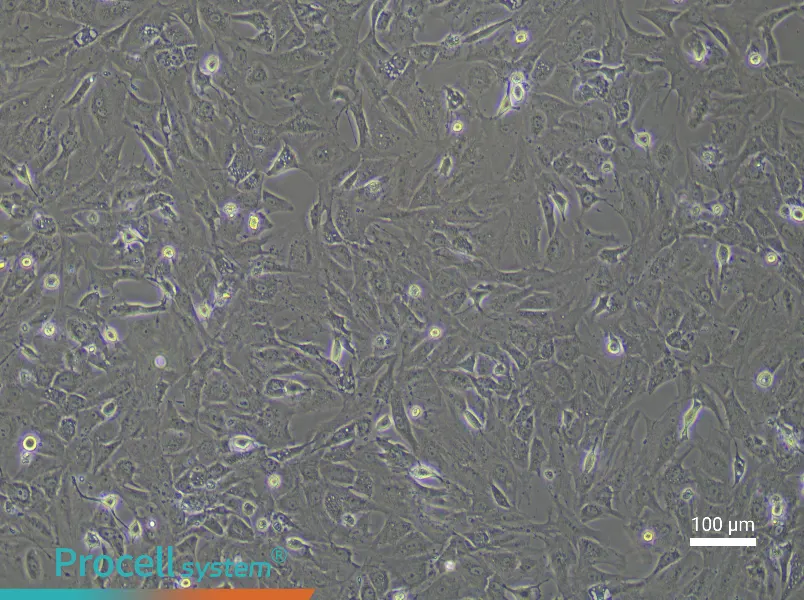 Rat Cardiac Fibroblast Complete Medium - 2