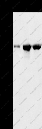 NAT10 Polyclonal Antibody - 1