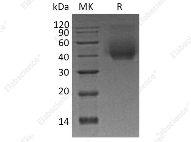 Recombinant Human CD44 Protein (His Tag) - 1