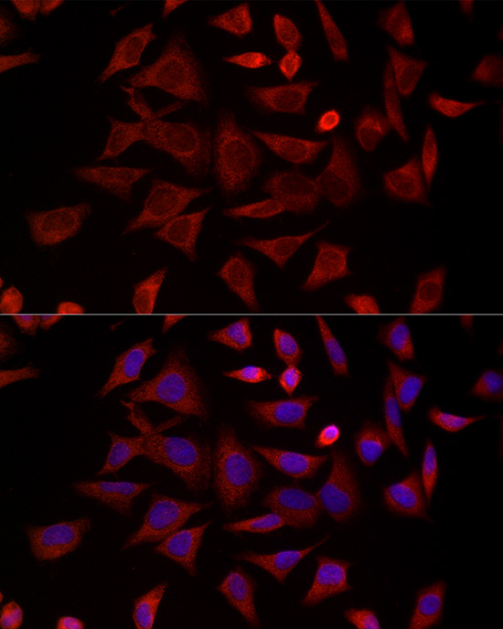 Immunofluorescence analysis of HeLa cells using CCT4 Polyclonal Antibody at dilution of 1:300 (40x lens). Blue: DAPI for nuclear staining.