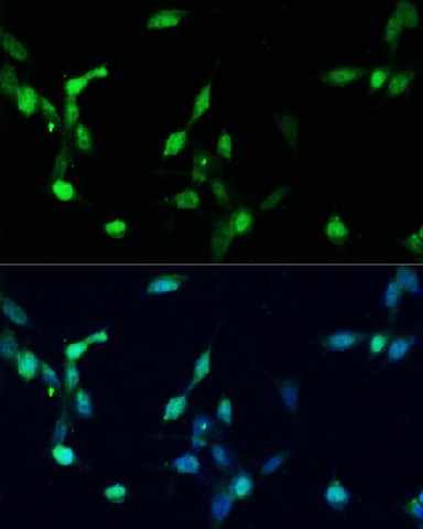 Immunofluorescence analysis of NIH/3T3 cells using p27 KIP 1 Polyclonal Antibody at dilution of 1:100. Blue: DAPI for nuclear staining.