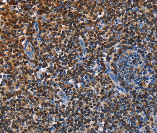 Immunohistochemistry of paraffin-embedded Human tonsil tissue using ENPP5 Polyclonal Antibody at dilution 1:40