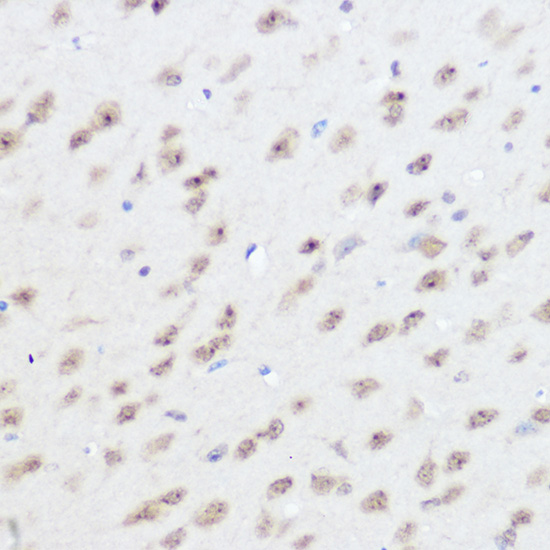 Immunohistochemistry of paraffin-embedded mouse brain using UFM1 Polyclonal Antibody at dilution of 1:300 (40x lens).Perform high pressure antigen retrieval with 10 mM citrate buffer pH 6.0 before commencing with IHC staining protocol.