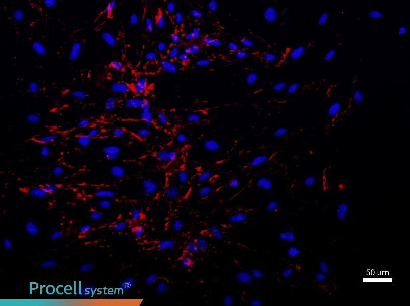Mouse Brain Microvascular Endothelial Cell Complete Medium - 1
