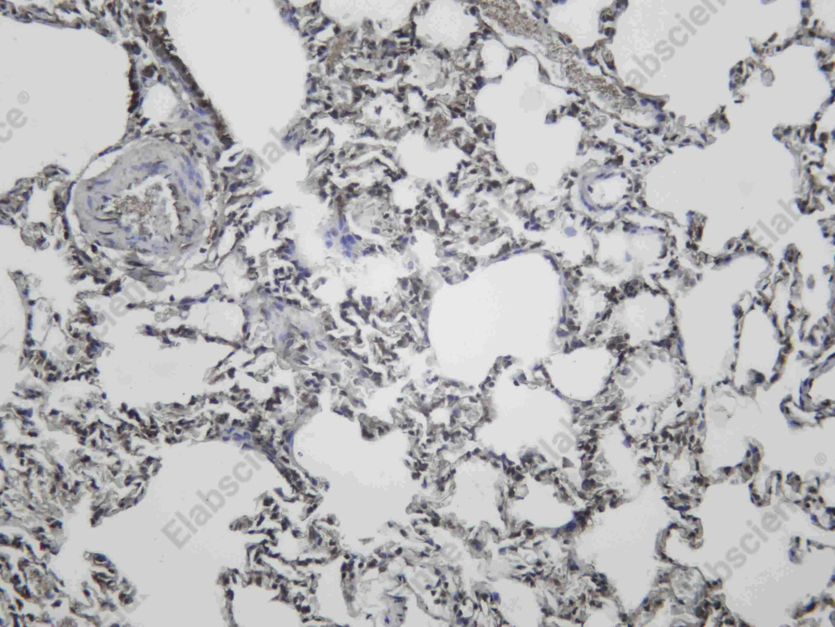 Recombinant VPRBP Monoclonal Antibody - 4