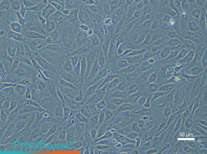 Human Pulmonary Great Vein Endothelial Cell Complete Medium - 5