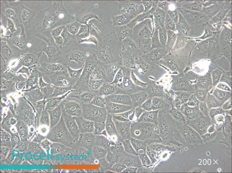 NCI-H1693 Cell Complete Medium - 6