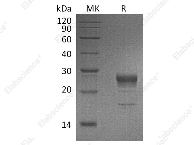 Recombinant Human FGF-7/KGF Protein (His Tag) - 1