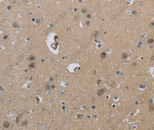 HSD3B1 Polyclonal Antibody - 3