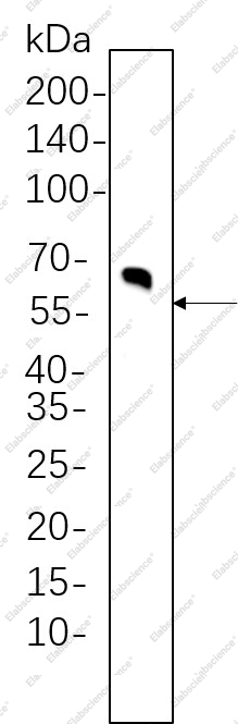 Recombinant Tyrosine Hydroxylase Monoclonal Antibody - 1