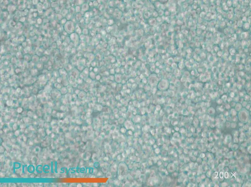 SU-DHL-2 Cell Complete Medium - 6