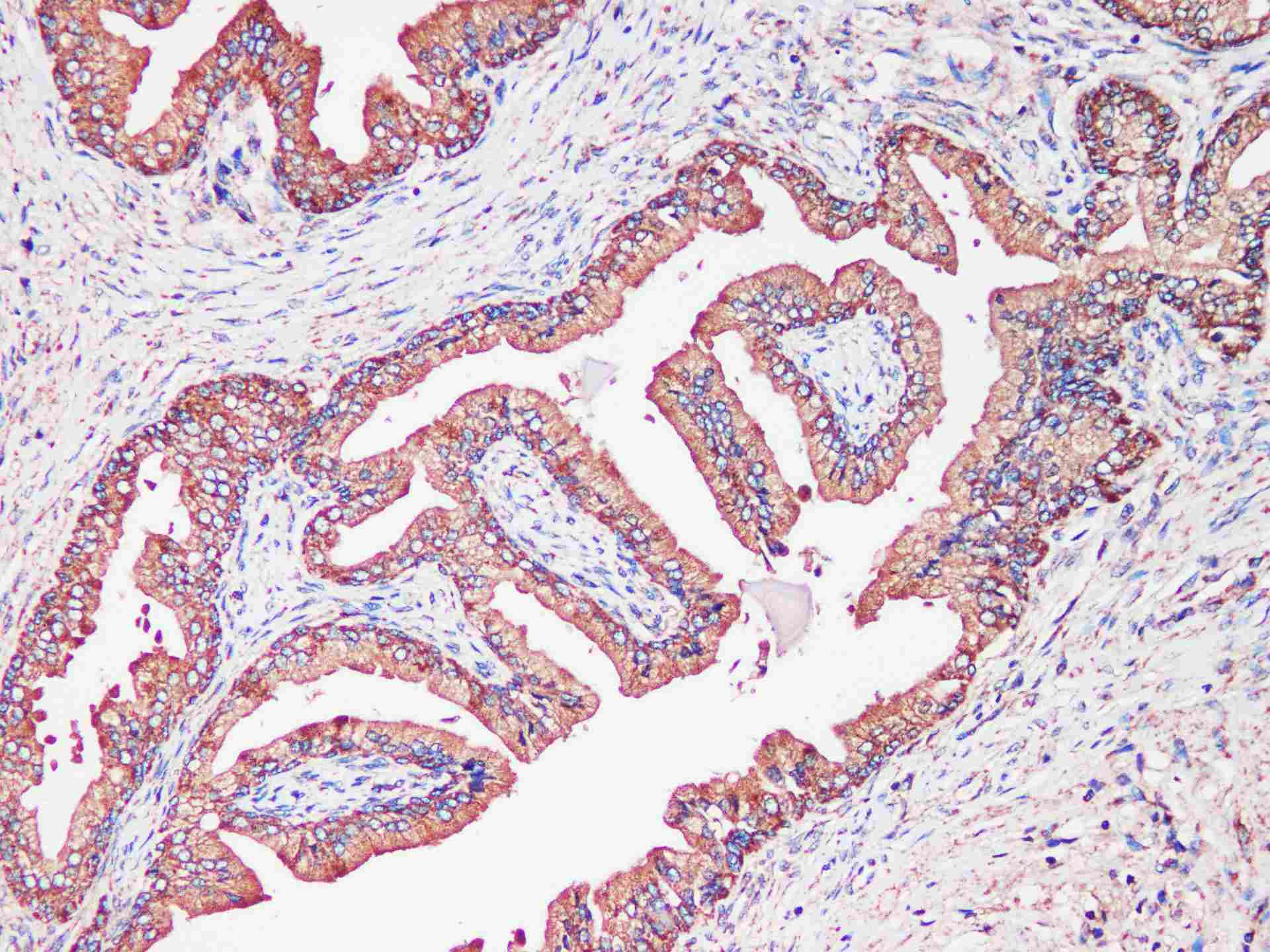 Tf Polyclonal Antibody - 3