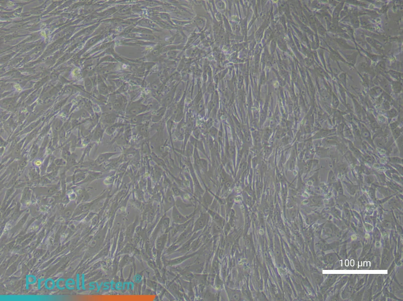 Human Preadipocyte Complete Medium - 2