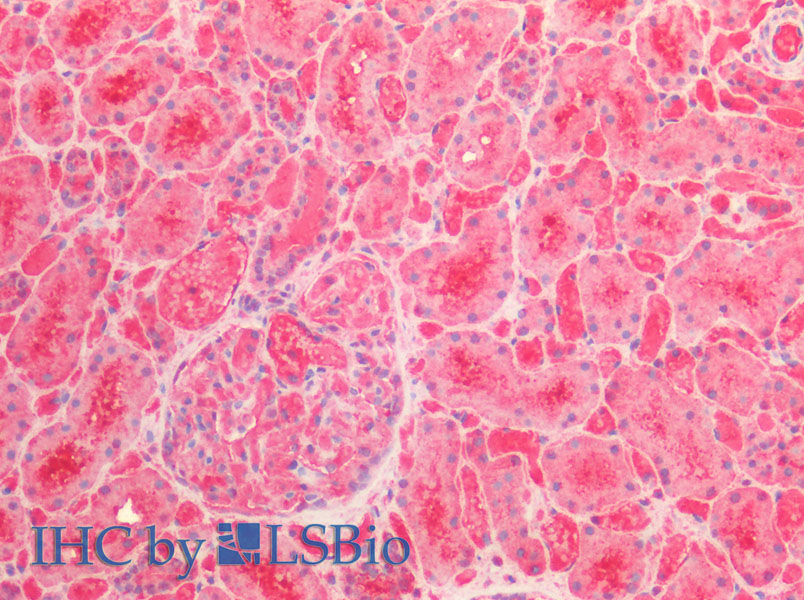 Immunohistochemistry of paraffin-embedded Human Kidney using ENO1 Polyclonal Antibody at dilution of 1:100(Elabscience Product Detected by Lifespan).