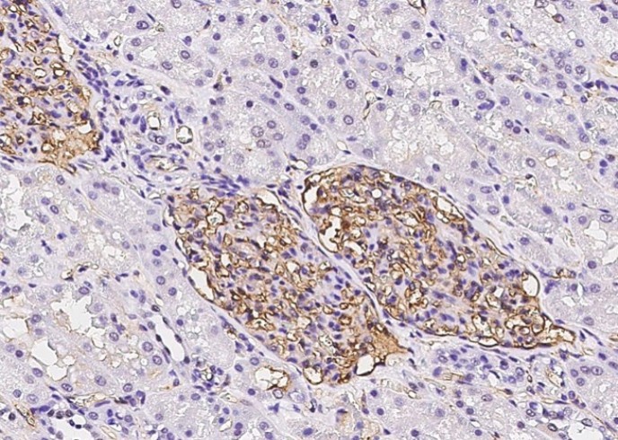 ICAM-1/CD54 Monoclonal Antibody - small - 2
