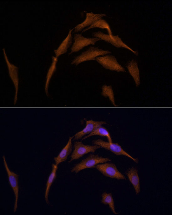 Immunofluorescence analysis of HeLa using AMPKα2 Polyclonal Antibody at dilution of 1:100 (40x lens). Blue:DAPI for nuclear staining.