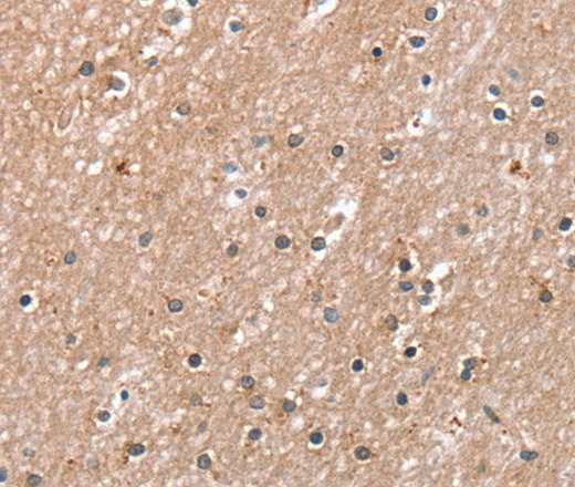 Immunohistochemistry of paraffin-embedded Human brain using RAB8A Polyclonal Antibody at dilution of 1:45