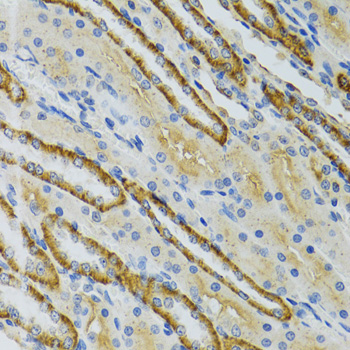 Immunohistochemistry of paraffin-embedded mouse kidney using COG2 Polyclonal antibody at dilution of 1:100 (40x lens).Perform microwave antigen retrieval with 10 mM PBS buffer pH 7.2 before commencing with IHC staining protocol.