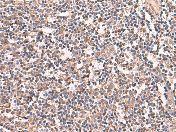 Immunohistochemistry of paraffin-embedded Human tonsil tissue  using RIOK1 Polyclonal Antibody at dilution of 1:60(?200)