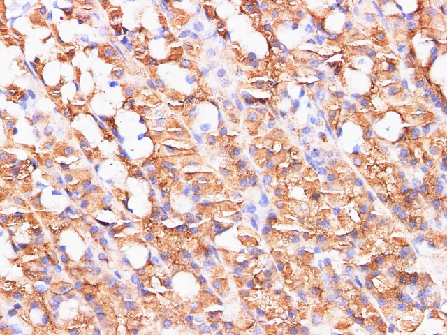 Immunohistochemistry of paraffin-embedded Rat stomach using S100A9 Polyclonl Antibody at dilution of 1:200 (400 x).