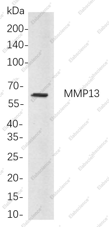 Recombinant MMP13 Monoclonal Antibody - 1