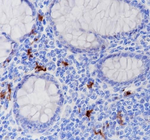 Recombinant IDO1 Monoclonal Antibody - 2