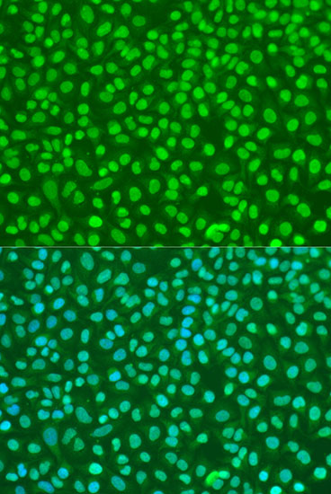 Immunofluorescence analysis of U2OS cells using NBN Polyclonal Antibody at dilution of  1:100. Blue: DAPI for nuclear staining.