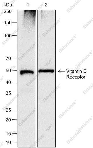 Recombinant Vitamin D Receptor Monoclonal Antibody - 1