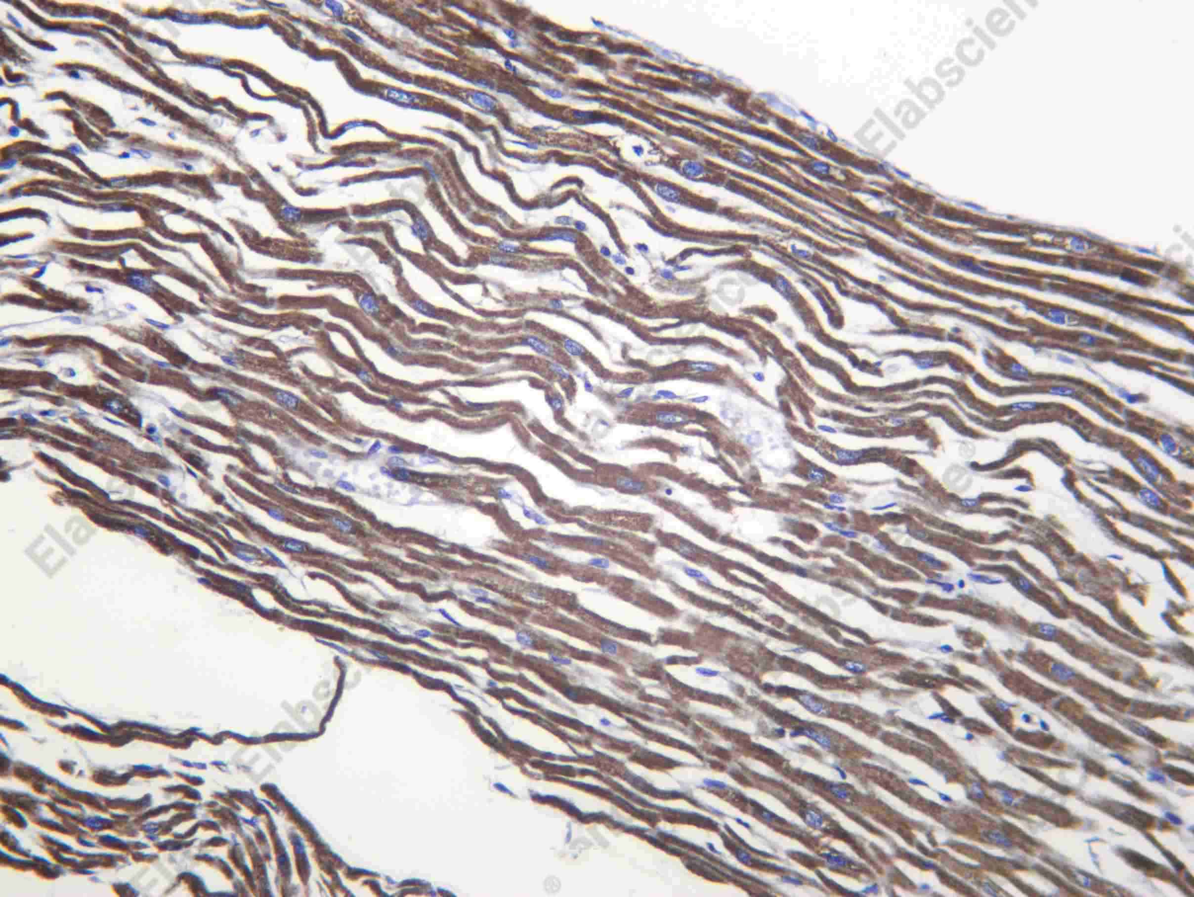 Recombinant OGDH Monoclonal Antibody - 1