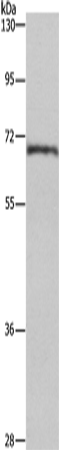 Western Blot analysis of Human normal liver tissue using HSF27 Polyclonal Antibody at dilution of 1:655