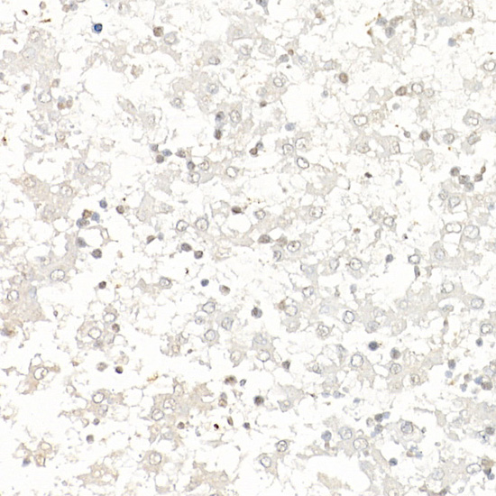 Immunohistochemistry of paraffin-embedded rat fetal liver using Survivin Polyclonal antibody at dilution of 1:25 (40x lens).Perform high pressure antigen r