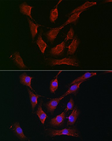 Immunofluorescence analysis of NIH-3T3 cells using RPS6KA1/RPS6KA2/RPS6KA3 Polyclonal Antibody at dilution of 1:200 (40x lens). Blue: DAPI for nuclear staining.