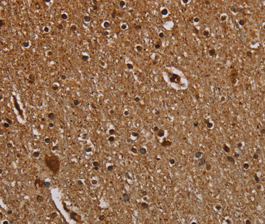 Immunohistochemistry of paraffin-embedded Human brain  tissue using DCAF6 Polyclonal Antibody at dilution 1:50