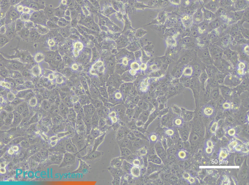 NCI-H1915 - 6