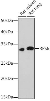 Western blot analysis of extracts of various cell lines using RPS6 Polyclonal Antibody at dilution of 1:1000.