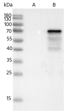 Recombinant Phospho-Tau (Thr217) Monoclonal Antibody - small - 4
