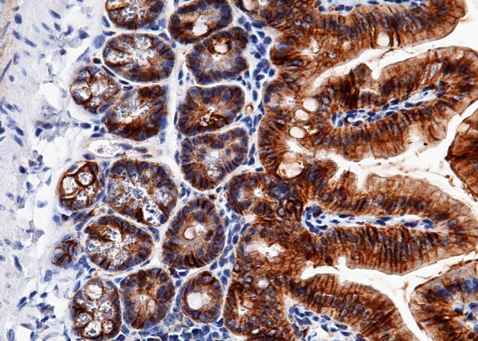 Recombinant EpCAM/TROP-1/TACSTD1 Monoclonal Antibody - small - 3