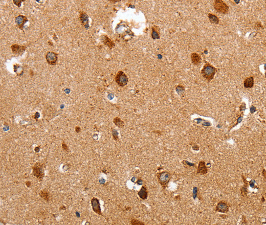 Immunohistochemistry of paraffin-embedded Human brain using HSP75 Polyclonal Antibody at dilution of 1:60