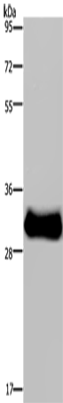 Western Blot analysis of Mouse skeletal muscle tissue using FHL3 Polyclonal Antibody at dilution of 1:1600