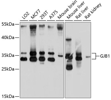 Western blot analysis of extracts of various cell lines using GJB1 Polyclonal Antibody at 1:1000 dilution.