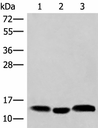 Western blot analysis of Human plasma solution Human placenta tissue Human gastric tissue lysates  using HBE1 Polyclonal Antibody at dilution of 1:200