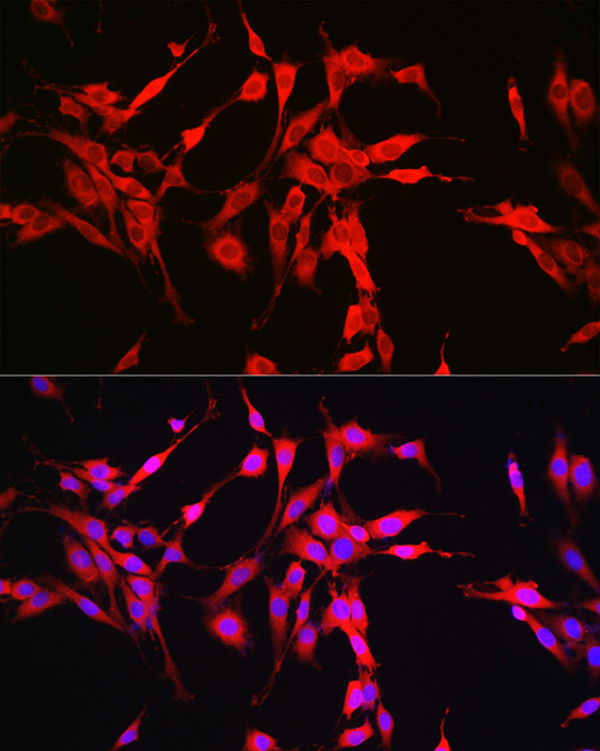 Immunofluorescence analysis of PC-12 cells using Glutaminase (GLS) Polyclonal antibody at dilution of 1:150. Blue: DAPI for nuclear staining.