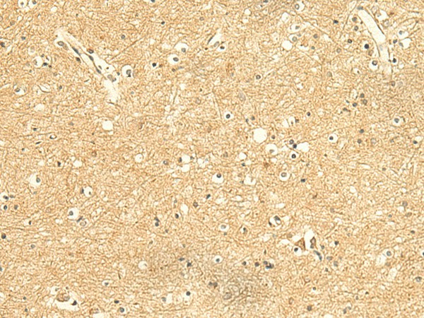 Immunohistochemistry of paraffin-embedded Human brain tissue  using KIAA0513 Polyclonal Antibody at dilution of 1:50(?200)