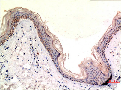 Immunohistochemistry of paraffin-embedded Human skin tissue using MLKL Monoclonal Antibody at dilution of 1:200.