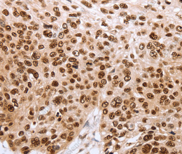PARP1 Polyclonal Antibody - 3