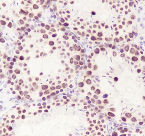 Recombinant HMGB2 Monoclonal Antibody - 3