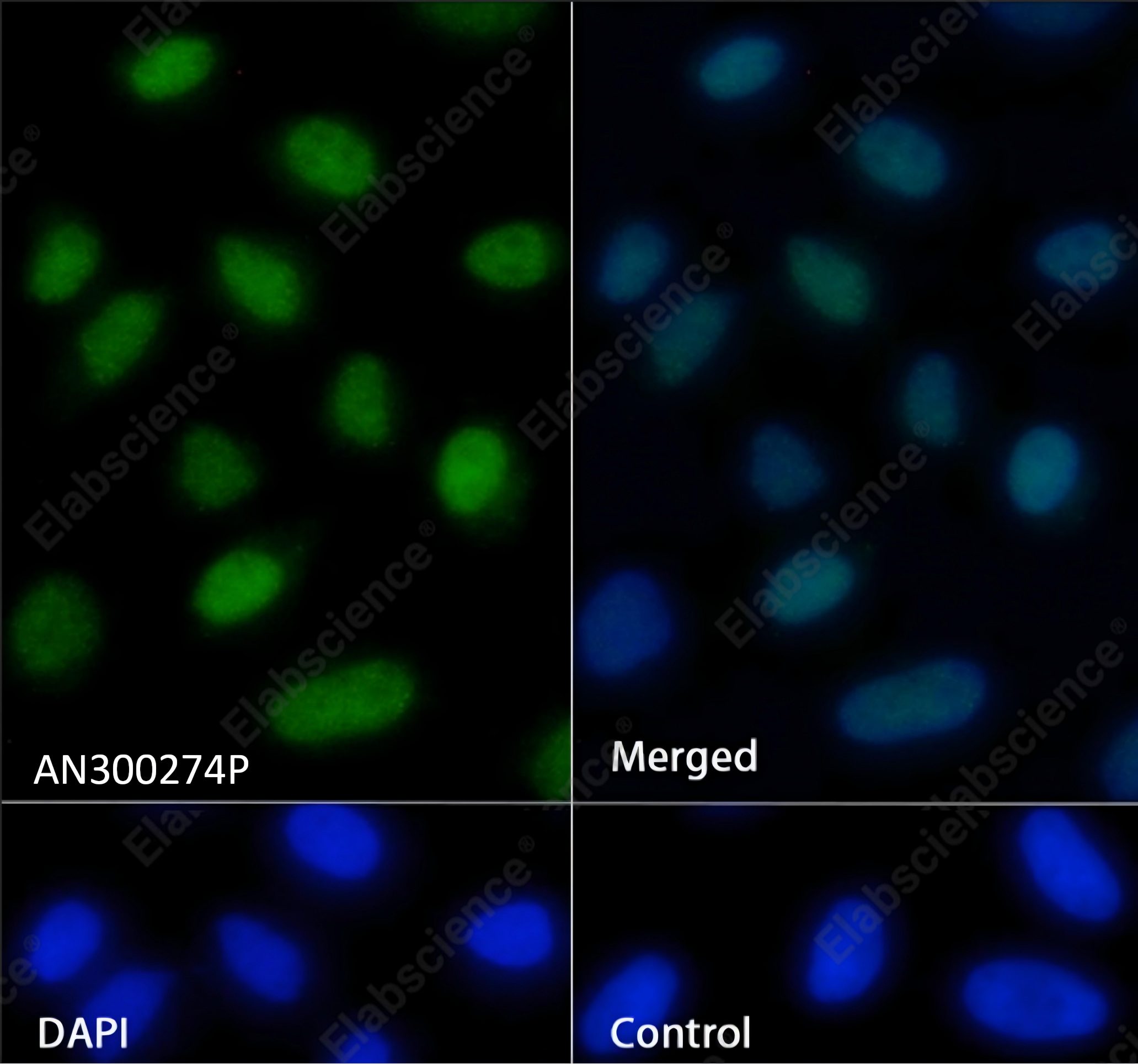 Recombinant ING5 Monoclonal Antibody - 2