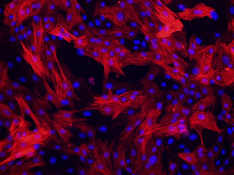 Rat Pulmonary Great Artery Smooth Muscle Cell Complete Medium - 3