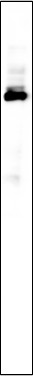 Recombinant BRAT1 Monoclonal Antibody-searchlist-1